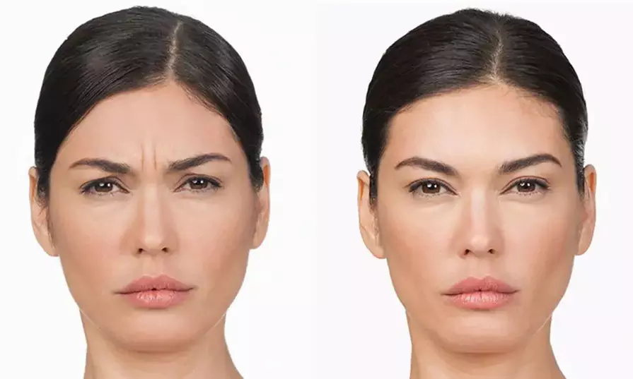 Expert Injectables to Smooth Wrinkles & Enhance Beauty