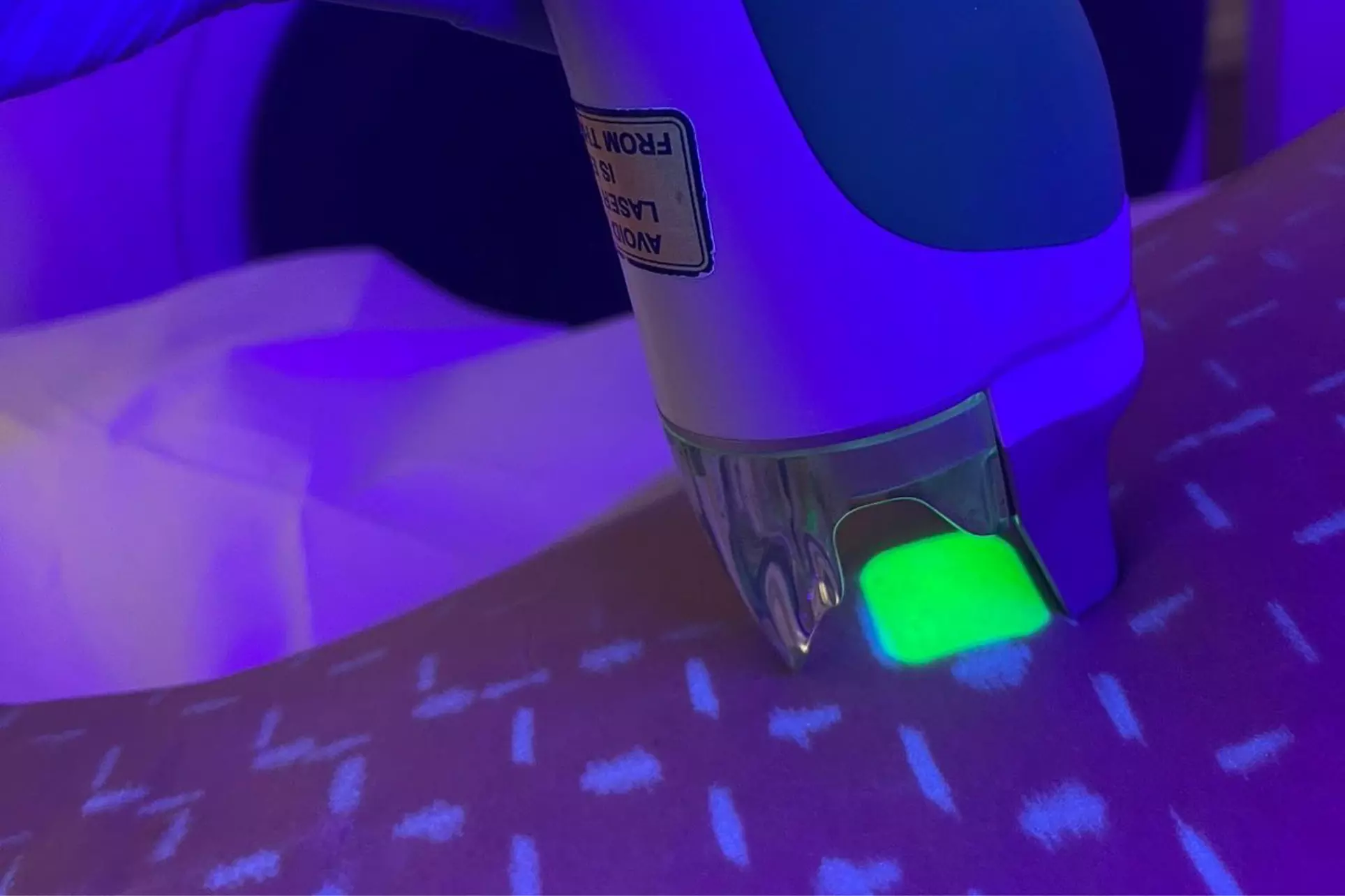 Laser Hair Removal (Summer Special for Women or Men): Choose Your Area