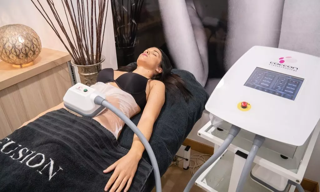 Sesiones de criolipólisis en Clínica Láser Fusión Alcalá