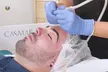 Tratamiento con exosomas y dermapen en 1 o 3 zonas a elegir, para una persona, en Centro de Estética Lorena Robles - Image 2