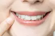 Checkup, Scale, & Polish or Teeth Whitening with In-Home Trays for Brighter Smile at KBM Dental (Up to €101 Off) - Image 2