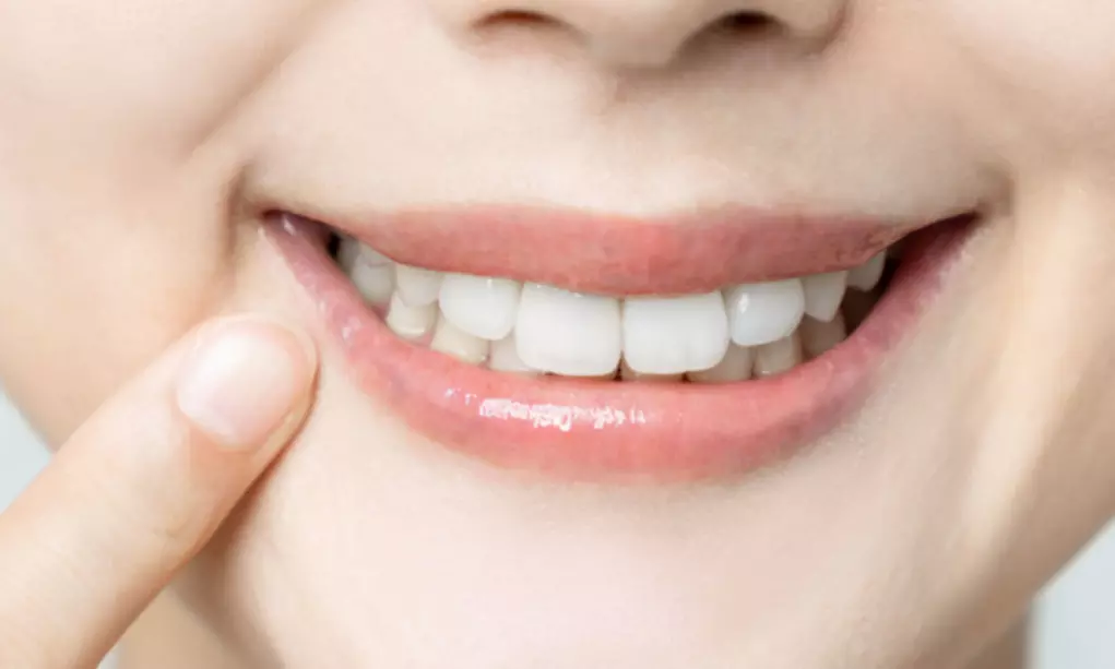 Checkup, Scale, and Polish or Teeth Whitening with In-Home Trays
