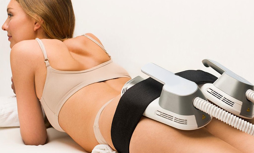 Image 1: 3 o 6 sesiones de electroestimulación corporal en una zona a elegir