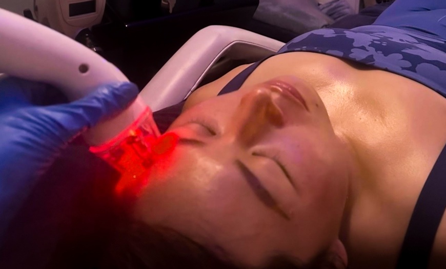 Image 2: Thermalifting skin-tightening treatments for smoother skin