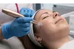 60 Min. Diamant-Mikrodermabrasion oder Microneedling für 1 Person (bis zu 58% sparen) - Image 2