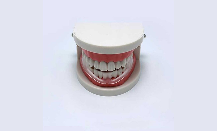 Image 5: One, Two or Four Anti-Bruxism Mouthguards for Tooth Wear Prevention