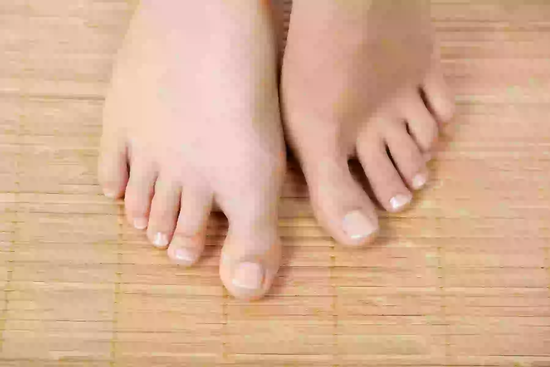 Up to 75% Off on Medical Foot Care at Viva skin health center