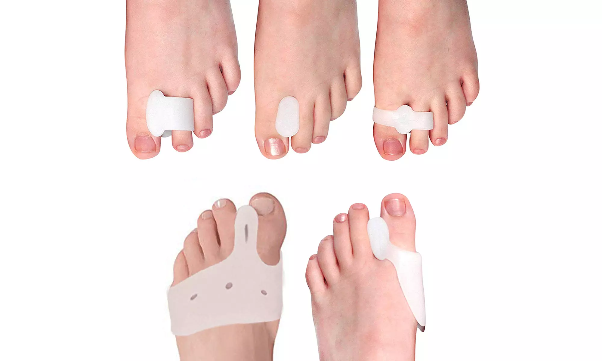 10-delige gezondheidskit voor tenen 'Bunion Buddy'