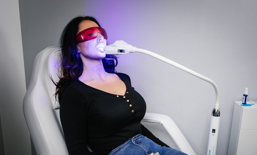 Image 3: 1 or 2 Sessions of 60-Minute Laser Teeth Whitening