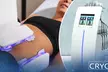 Bilan minceur complet et traitement par cryolipolyse de 2 zones (au choix) avec 10 centres Institut Cryo participants - Image 2