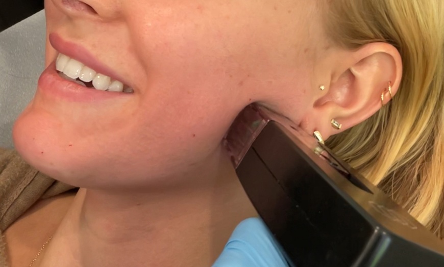 Image 3: Achieve Smooth Skin with Morpheus 8 and Light Therapy