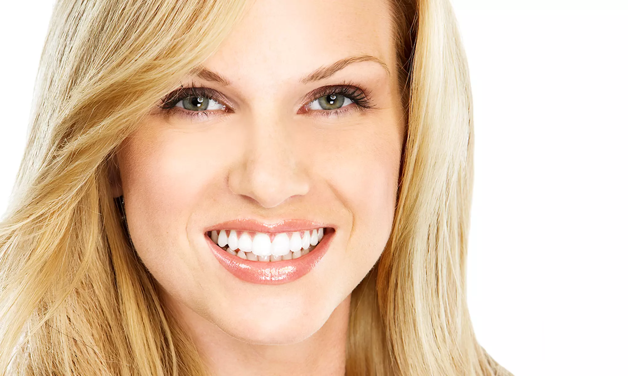 $86.50 for a Dental-Checkup Package with Whitening Kit or $100 Credit at Radiant Smiles Dental ($643 Value) - Primary Image