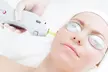 Valentine’s Special 3 or 6 Sessions of Laser Hair Removal at Laser and You (Up to 87% Off) - Second Medium