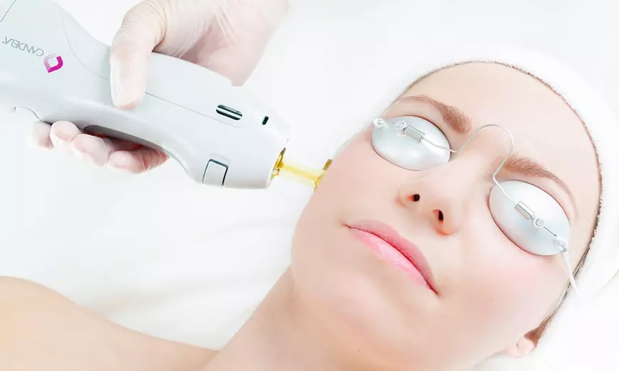 Image 2: Six Laser Hair Removal Sessions