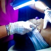 Image 2: Get 1, 2 or 3 Microdermabrasion or Dermaplaning Treatment with Facial 