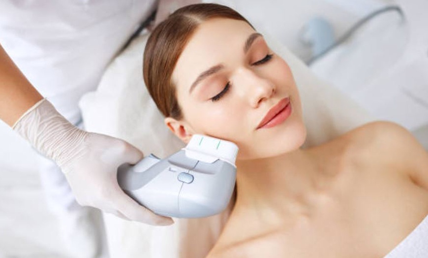 Image 1: Tratamiento HIFU ultralifting en rostro o cuerpo en Body Magic Sthetic