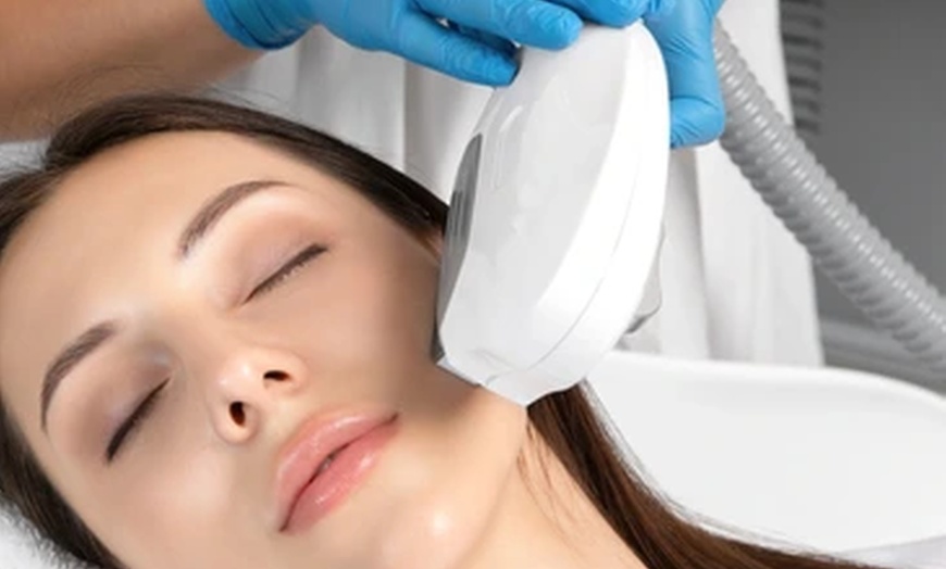 Image 2: Transform Your Skin with One, Two or Three IPL Photo Facials