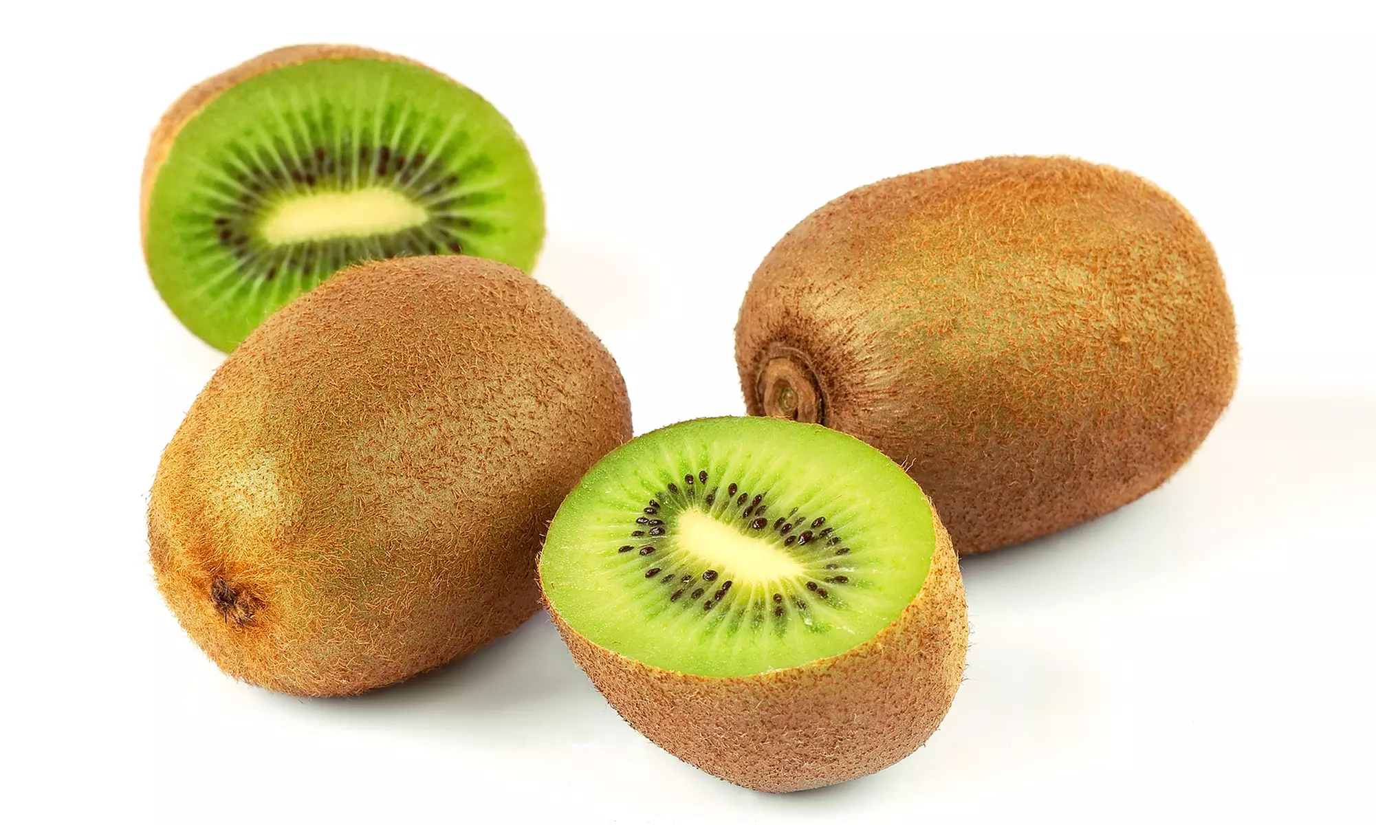 Conjunto de Actinidia deliciosa 'Jenny'