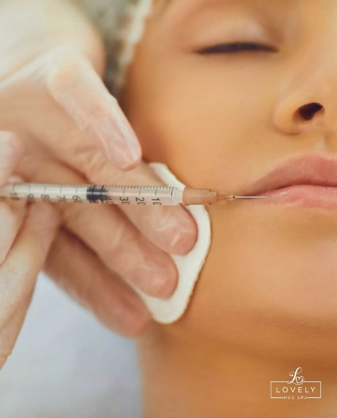 Up to 35% Off on Injection - Dermal Filler at Lovely Med spa - Primary Image