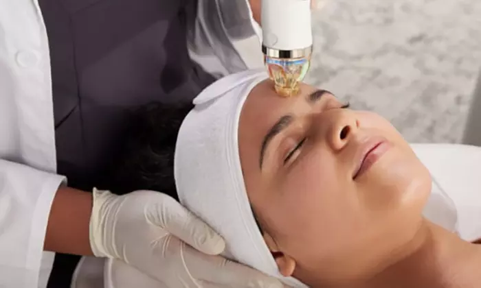 SecretPro RF Microneedling Session at Precision Medicine & Wellness - Primary Image