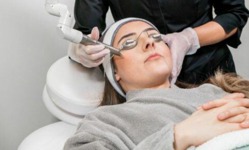 Image 1: Erbium YAG Laser Resurfacing for Flawless Skin at SculptMe Med Spa 