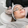 Image 1: Erbium YAG Laser Resurfacing for Flawless Skin at SculptMe Med Spa 