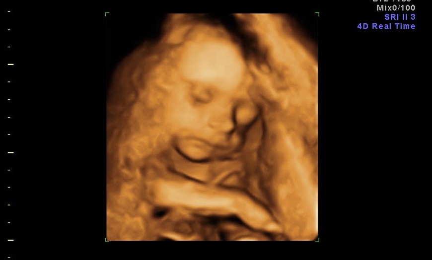 Image 2: 3D/ 4D Baby Scan