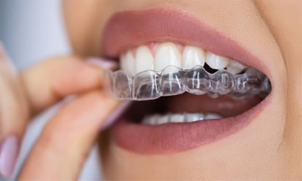 Paga 19 € y consigue un descuento de 350 € en un tratamiento de ortodoncia invisible - Clínica Dental Jaime III