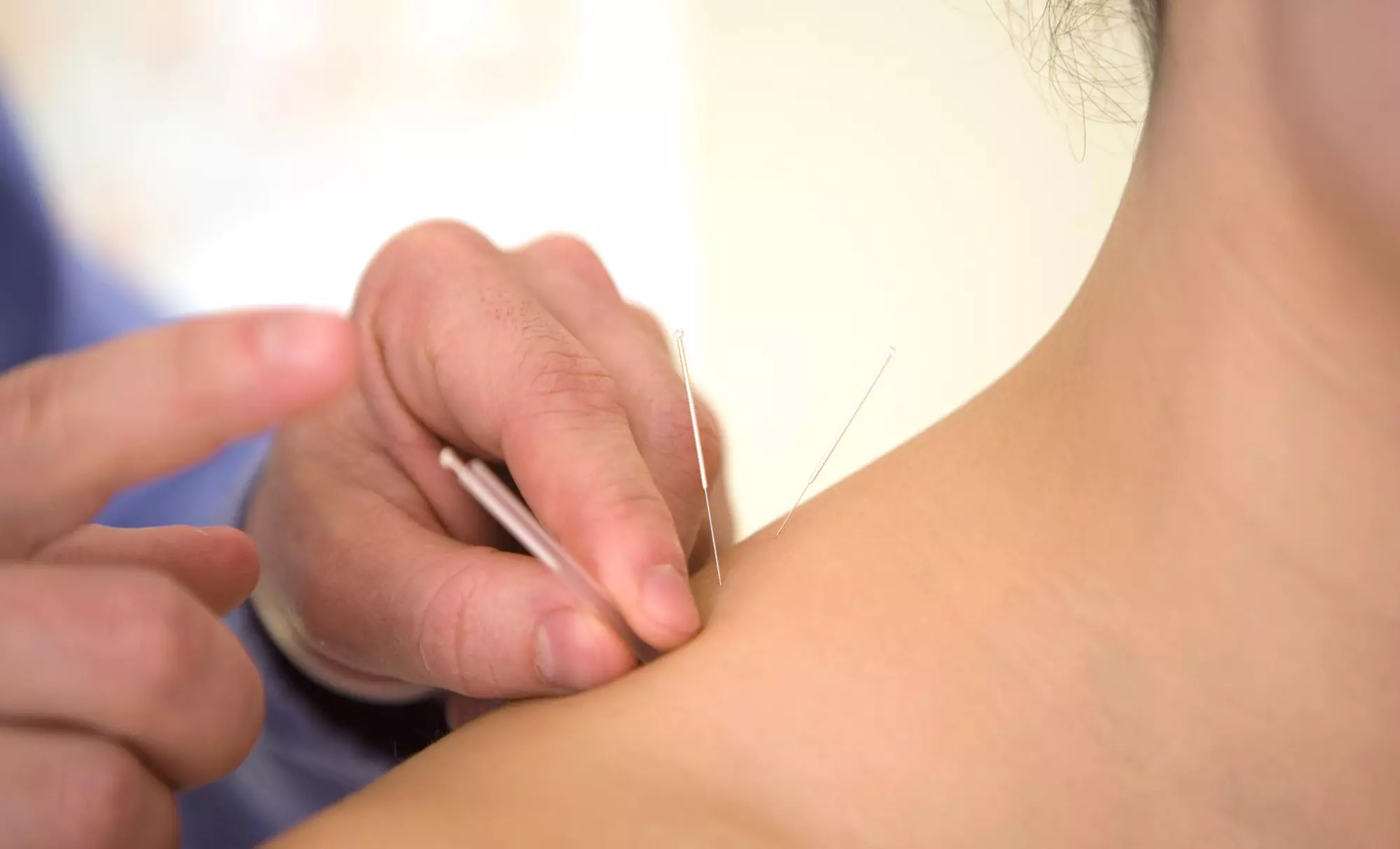 One, Three, or Six Acupuncture Sessions at Harvard Square Community Acupuncture (Up to 68% Off) - Primary Image