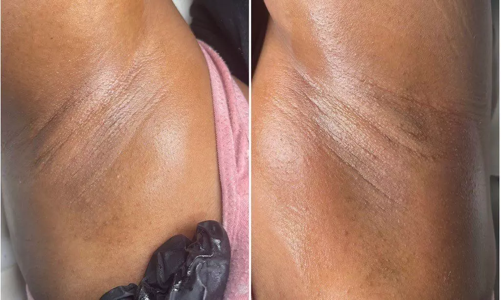 Women Brazilian Wax / Brazilian + Underarm / All-Gender Full Back Wax