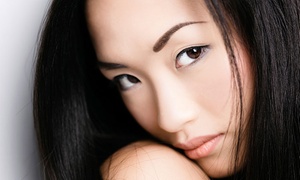 65% Off Botox at Advanced Laser Body Care