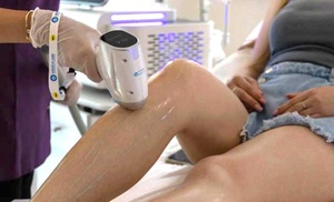 Pour une peau lisse : épilation laser IPL, zone au choix, à Bruxelles