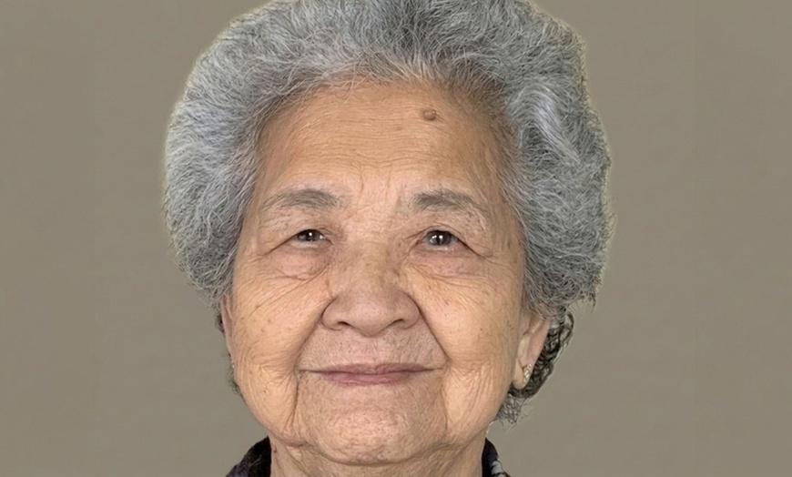 Image 6: 1, 3, or 5 Fractional Laser Skin Resurfacing Sessions for Full Face