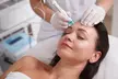 Get Glowing Skin with Our One or Three Sessions of Biorepeel Facial at Aries Lee Beauty (Upt o 70% off) - Second Medium