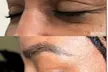 Revitalize Your Look with 20 or 40 Units of Botox at Jovial Med Spa (Up to 40% Off) - Second Medium