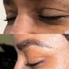 Image 6: Revitalize Your Look with 20 or 40 Units of Botox