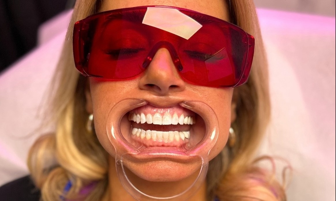 Revitalize Your Smile with Professional Teeth Whitening Options
