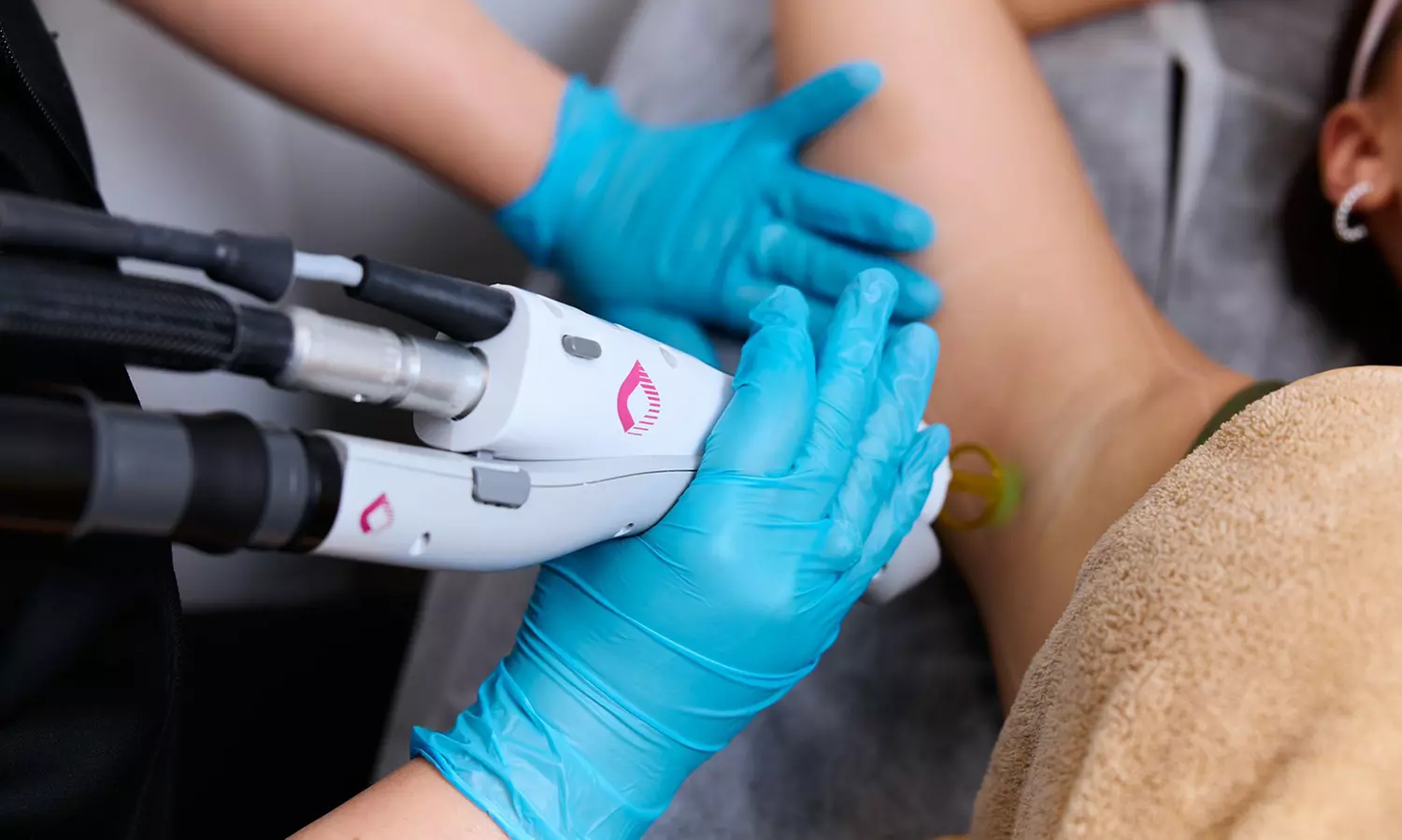 Up to 55% Off on Spa / Salon Beauty Treatments at I LASER YOU LLC