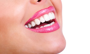 One-Hour Teeth Whitening