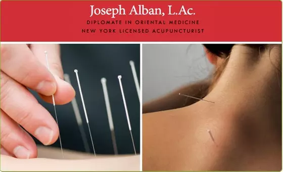 $45 for One Hour of Acupuncture (Normally $100) - Primary Image