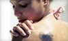 One, Three, or Six Laser Tattoo-Removal Sessions at Rethink the Ink in Littleton (Up to 74% Off)