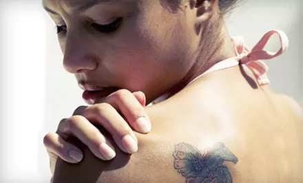 One, Three, or Six Laser Tattoo-Removal Sessions at Rethink the Ink in Littleton (Up to 74% Off) - Primary Image