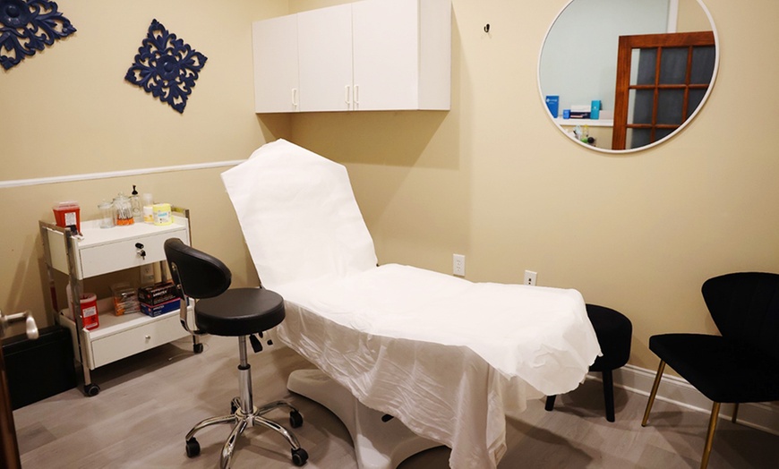 Image 3: Sculptra Treatments in Springfield, PA

