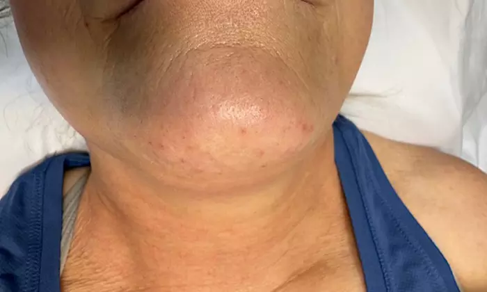 Relax with Cryo & Thermal Body sculpting (2 or 3 sessions) - Up to 50% Off