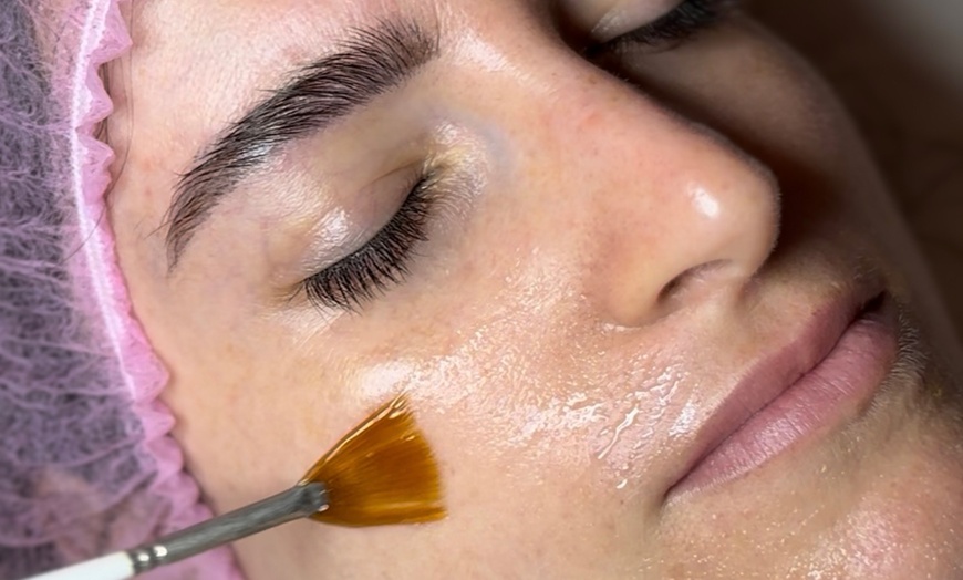 Image 7: Limpieza facial completa con opción a microdermoabrasión y máscara LED