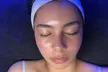Microdermabrasion Facial at Barbie's Esthetics with Facial Options and up to 34% Off! - Second Medium