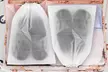 Transparent Shoe Bags for Travel Shoes Organizers Storage Pouch with Rope - Second Medium