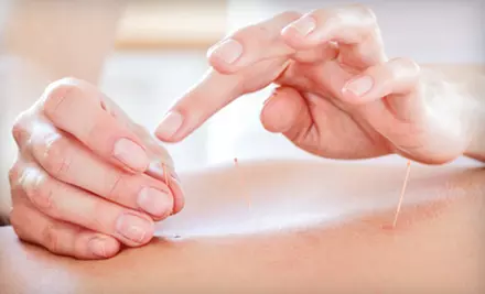 One or Two Integrated-Acupuncture Sessions at Ancient Rivers Healing Arts - Primary Image
