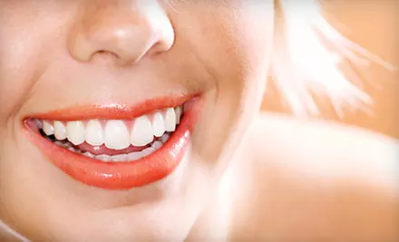 $89 for an In-Office Opalescence Boost Teeth-Whitening Treatment at South Beach Dental in Miami Beach ($300 Value) - Primary Image