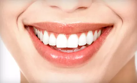 $149 for a BriteSmile In-Office Teeth-Whitening Treatment at Joseph A. Favia Dental Practice in Arlington Heights ($500 Value) - Primary Image